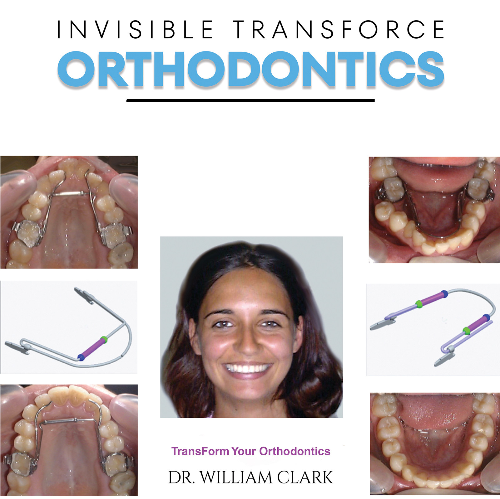 Invisible TransForce Orthodontics-bookcover