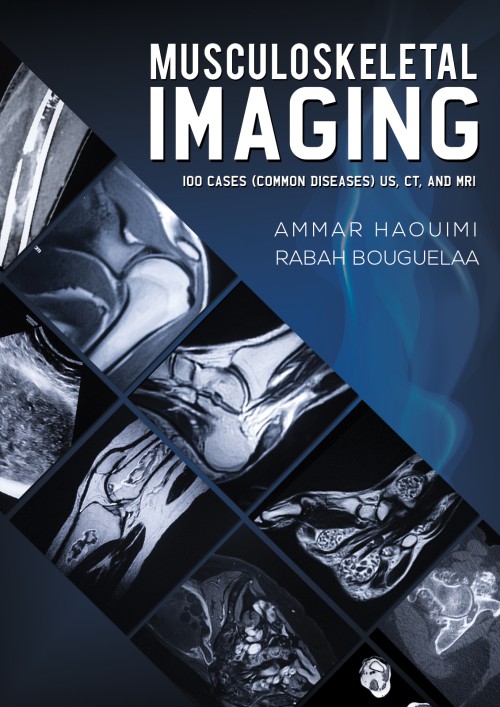 Musculoskeletal Imaging-bookcover